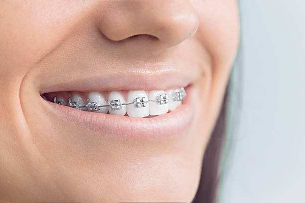 Best Invisalign and Clear Aligners  in Stockton, KS